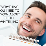 Everything You Need to Know About Teeth Whitening